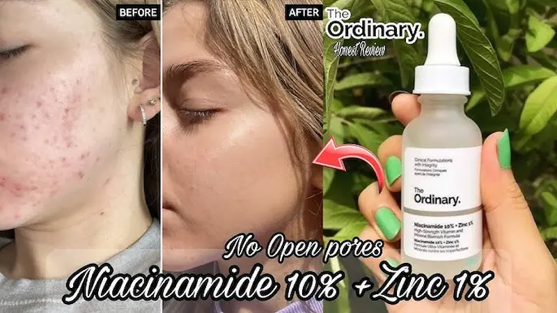 the ordinary niacinamide 10% + zinc 1%